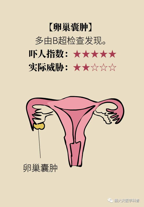 女性最怕的5种病,其实不算病