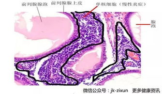 精满自溢，精满自溢是什么意思