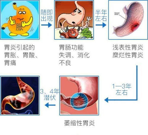 口臭原来是幽门螺杆菌在 捣鬼 坚持做好这些事,口臭悄悄远离你