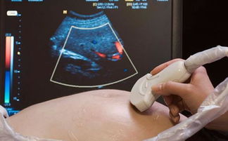 原创孕期B超做多了对胎儿不好？这2个检查才可能致畸