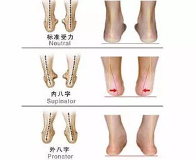 这三种走路姿势会让腿部变丑 内附美腿攻略