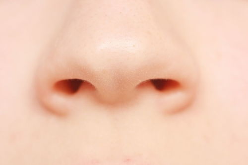 鼻子里面总是感觉痒痒是什么原因引起的 