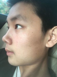 15岁男生长得怎么样鼻子是不是有点大还会变嘛 