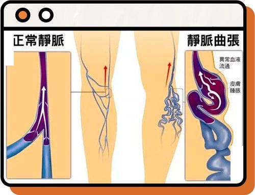 爱翘二郎腿的女生,真的要小心了