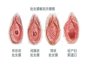 科普图解：处女膜在阴道什么位置