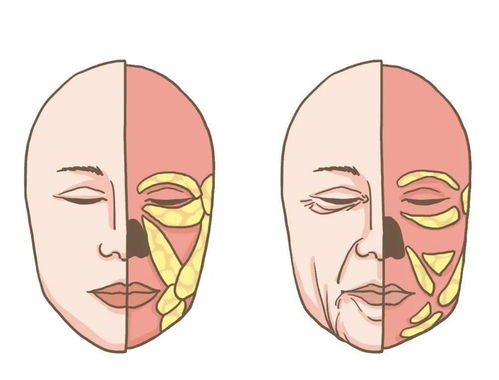 为什么人年纪变大后会发腮 