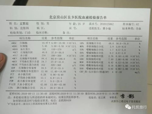 不履行合同不退钱算诈骗吗  第2张