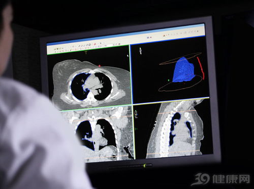 很多人不吸烟,为什么也会得肺癌 这6件事,同样把肺伤 透 了