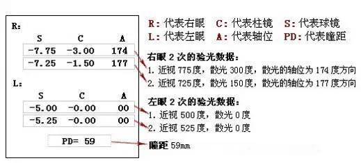 如何正确看懂验光单 S C A 都代表什么意思