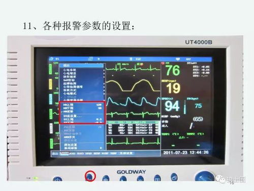 心电监护仪上这些数字表示什么