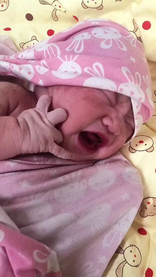 刚出生的婴儿手退皮正常吗,刚出生的婴儿手脱皮是怎么回事