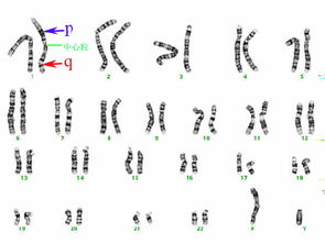染色体图片 搜狗图片搜索