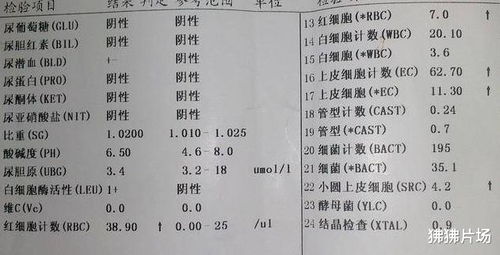 做ect打完针后喝水超过500毫升是否会影响检查结果(ect打的针有什么副作用)