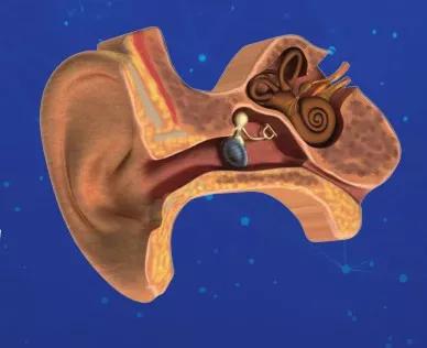 国际聋人节 出现这几种症状就有耳聋的风险 保护耳朵,刻不容缓