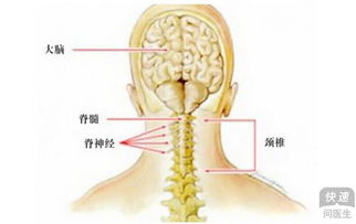 颈椎压迫神经根图片 图片搜索