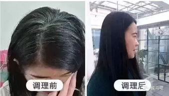 终于不用染发了 所有人都该看看的白发转黑发妙招,后悔没有早点知道它