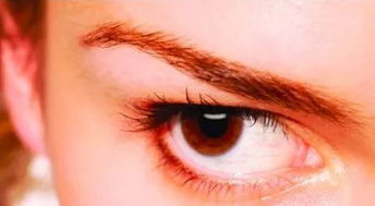 每晚按时睡觉眼睛里还是布满红血丝 注意,其实这些因素也会造成 红眼