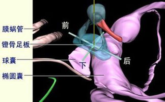 粘连中耳炎与鼓室硬化