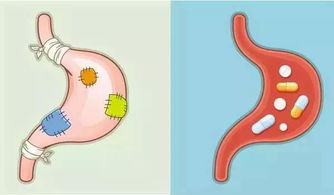关于养 胃 知识