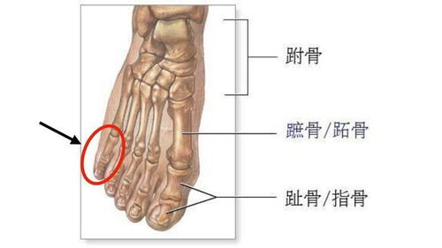 人体共有206块骨头,中国人却只有204块,少的两块去哪里了 