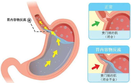 五岁男孩午休后突然离世,医生检查 这种情况已经不是第一次了