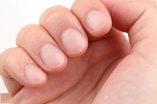 指甲上的 月牙 和 黑线 代表健康出了问题 关于指甲的这些知识你应该知道