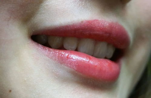 护唇的5个小技巧,助你拥有娇嫩的嘴唇,你知道具体是哪些吗
