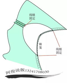 衣服肩垫可以拆么