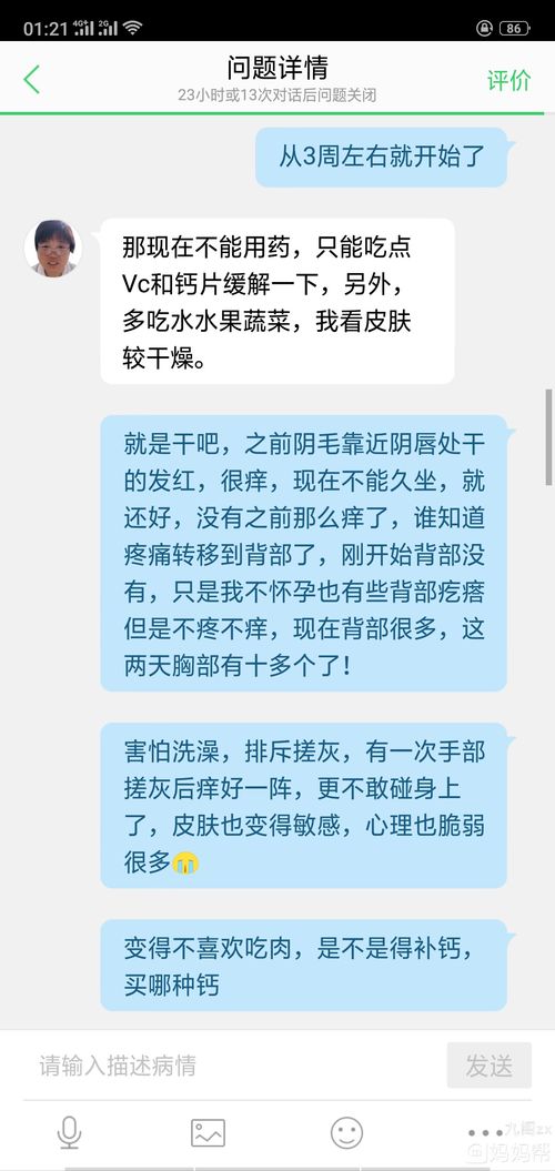 孕初期发痒厉害,很多医生不建议用药,只能忍