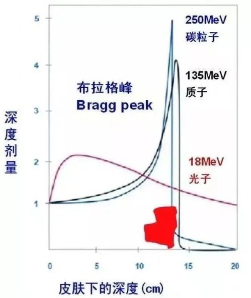 质子重离子治疗是什么意思 可以治疗哪些肿瘤