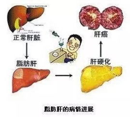 成大方圆寻找一千名肝病患者之旅活动开始啦 免费赠肝爽颗粒