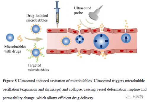 聚焦超声联合微泡开放血脑屏障增强脑靶向递送研究进展