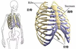 肋骨外翻能治好吗(肋骨外翻和正常图片对比)