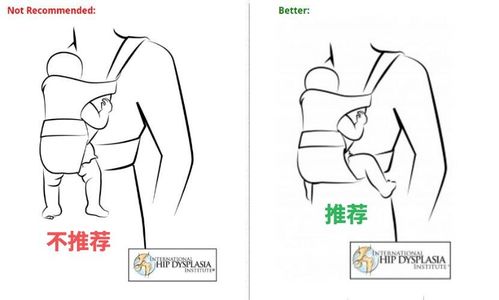 话说,还有人认为使用婴儿背带会导致宝宝O型腿吗