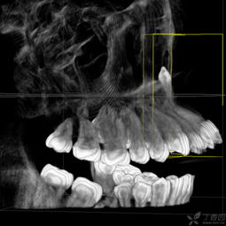 你知道为什么看牙需要拍口腔CT片吗(牙科为什么要拍片)