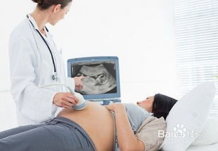 孕期主要检查项目有哪些呢 