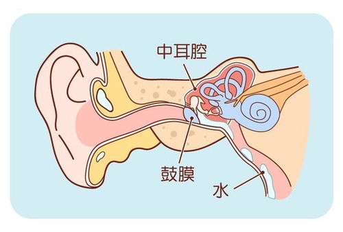 淋雨后耳朵不小心进水了怎么办