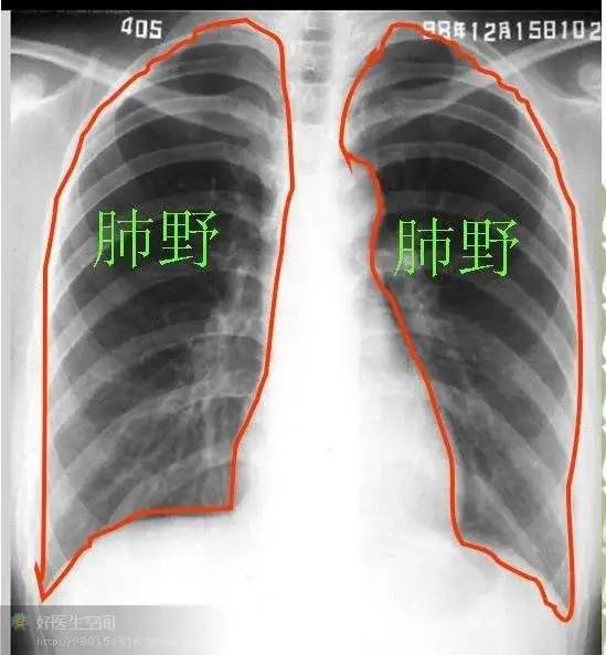 如何有序地閱讀胸片