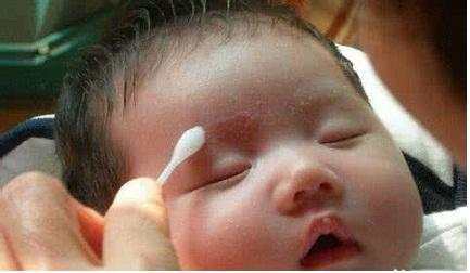 婴儿用黄柏水治湿疹,宝宝脸上长湿疹可以用复方黄柏液吗