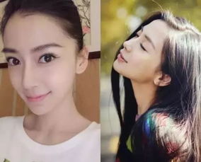 一直否认整容的Angelababy,她的整容史都可以出一本书了