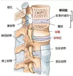 腰椎间盘突出现水肿期怎么止痛