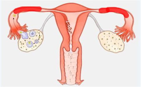 输卵管堵塞，怎么预防输卵管堵塞
