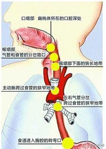 春节提醒丨瑞康医院耳鼻喉医生教你6招应对鱼刺卡喉 