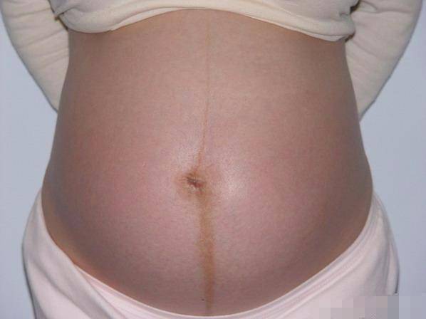 孕妈妈不知道肚子里的宝宝性别 其实,产科医生已经暗示给你了 