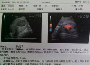原创怀孕期间，孕检单上若有3种“数据”可能是“小暖男”已在腹中！