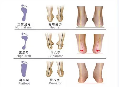 怎样挑选一双适合自己的跑鞋