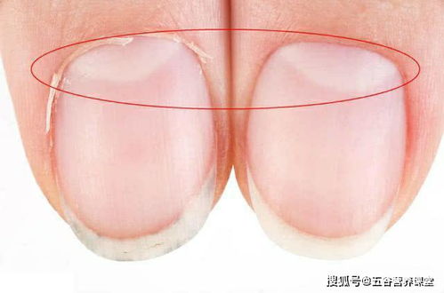 指甲上没有月牙与指甲上有的人,谁身体更健康 科学的解释来了
