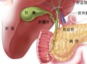 为何说胆结石，只要痛了一次，以后再次疼痛的几率非常大(胆结石一开始疼,后来不疼了就是好了吧)