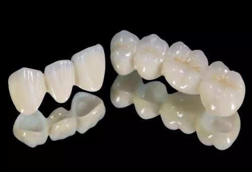 杭州时光整形 通过烤瓷牙来修复牙齿有哪些优点 