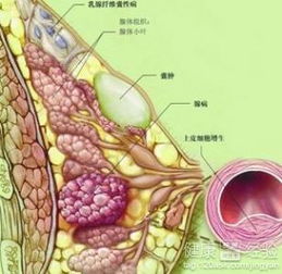 乳腺纤维瘤会癌变吗做手术怎么样